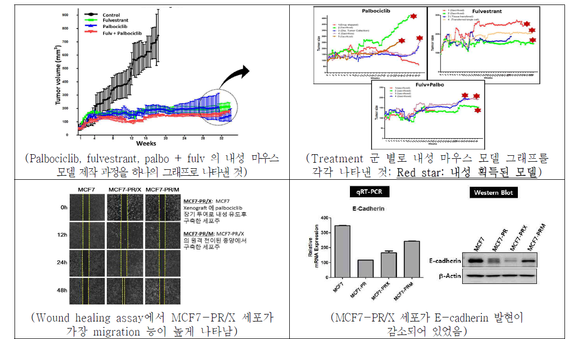 In vivo Palbociclib ± fulvestrant 내성 모델