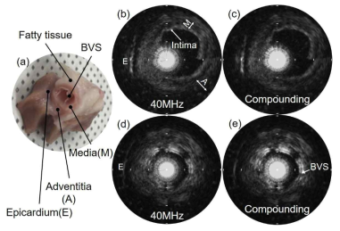 (a) 생분해형 스텐트를 ex-vivo 돼지 심혈관 내부에 삽입한 후 Native vessel로부터 (b) 40 MHz fundamental, (c) compounding 방법으로 데이터를 획득했으며, Stented vessel로부터 40 MHz Fundamental, (e) Compounding 방법으로 데이터롤 획득하였음