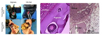 (좌) 서로 다른 생체재료에 따른 이식된 인공 난소 생착 정도 (우) 인공 난소 이식 후 7일 째 H&E염색을 통한 histology 확인 (algiante군 및 HA-Gel군)