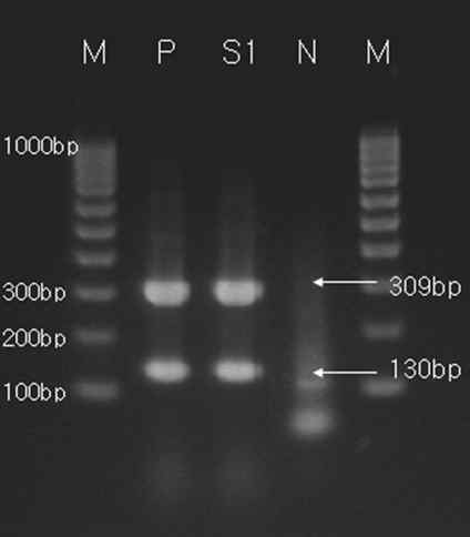 JUNAH의 PCR 검사 결과