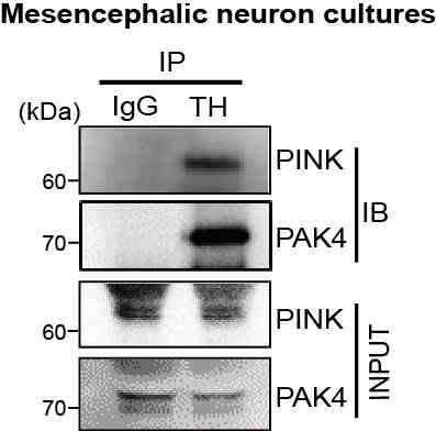 Rat primary mesencephalic neuron cultures (도파민 신경세포 배양세포)에서 immunoprecipitation 실험을 통해서 PINK1 단백질과 PAK4 단백질이 도파민 신경세포 내에서 결합하고 있음을 확인하였음