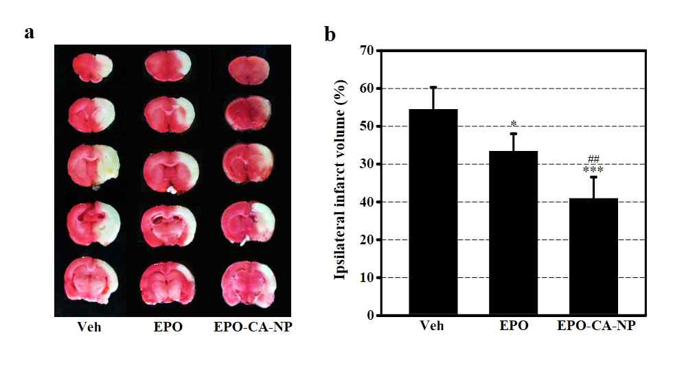 erythropoietin-PLGA-나노입자의 뇌경색 부피 감소 효과