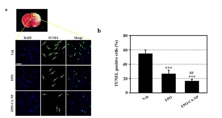 erythropoietin-PLGA-나노입자의 신경세포 자멸사 억제 효과