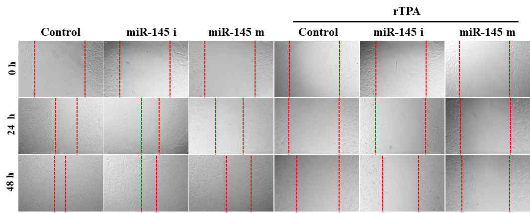 miR-145의 agomir /antagomir와 rTPA를 같이 처리 했을 때 세포의 이동 속도 변화 확인