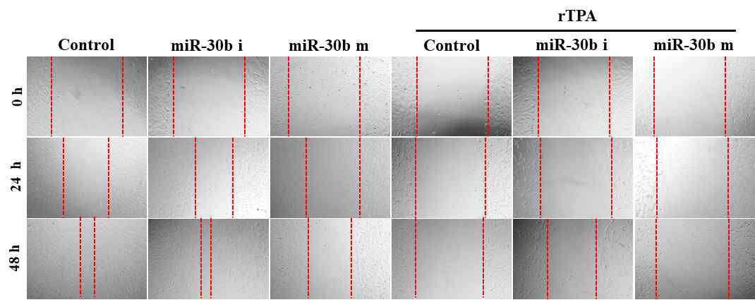 miR-30b의 agomir /antagomir와 rTPA를 같이 처리 했을 때 세포의 이동 속도 변화 확인