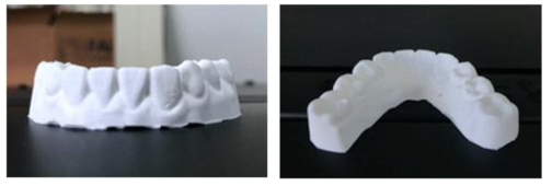 광경화성 3D 프린터로 출력한 세라믹 치과용 모형 출력 사진(알루미나)