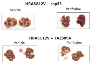 YAP/TAZ 가 활성화 정도에 따른 AKT 저해제의 항암효과. YAP/TAZ 신호가 활성화되지 않은 간암모델(HRASG12V+shp53)에서는 perfosine 항암효과가 나타났으나, 활성화된 간암모델 (HRASG12V+TAZS89A) 에서는 효과가 없었음