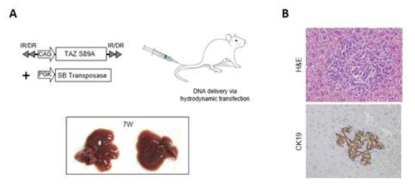 정상 마우스 조직에 비해 HRas+ shp53 간암 마우스 모델에서 TAZ의 발현량이 높은 것을 확인하고 이를 토대로 Hydrodynamic transfection을 통해 TAZ 유전자를 단독으로 발현시킨 후 biliary/progenitor cell marker인 CK19로 IHC 한 결과 positive하게 발현되는 세포들을 확인. 이는 hepatocyte의 de-differentiation을 의미
