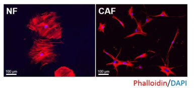 LF와 CAF의 세포형태 비교