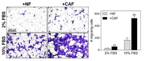 CAF가 폐암세포의 이동에 미치는 영향
