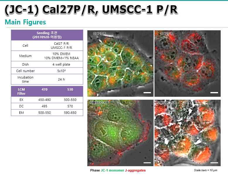 두경부암세포주와 약물저항성을 획득한 두경주암 세포주에서의 마이토콘드리아의 활성도