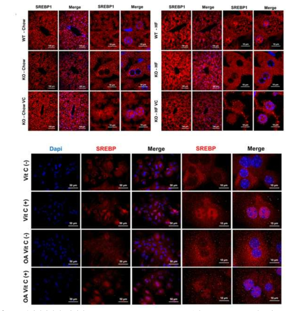 면역형광항체 염색법 (immunofluorescence staining) 결과, Liver tissue (위) 및 Isolated primary hepatocyte (아래)에서 모두, SREBP-1c (Red)의 핵(Blue) 내 이동에 비타민C가 필수적이라는 결과를 얻을 수 있었다