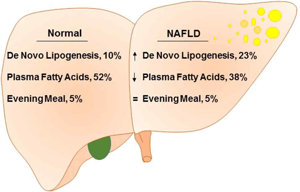 NAFLD를 가지지 않는 비만환자와 (Normal), 비알코올성 지방간증 소견을 가진 비만환자 (NAFLD) 의 metabolism rate 분석 결과, NAFLD 환자에서 DNL pathway가 유의성 있게 증가하는 것이 보고된 바 있다