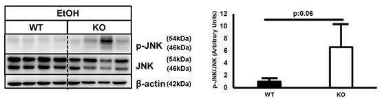 JNK의 active form인 p-JNK가 SMP30 Knockout 마우스에서 확연히 증가한 것을 관찰할 수 있음