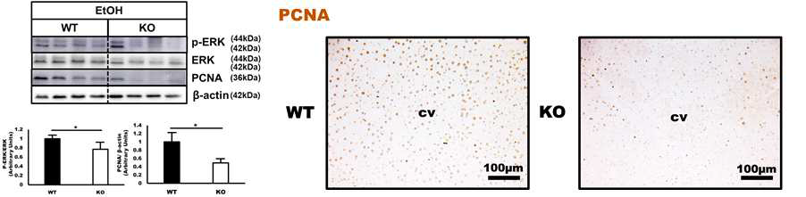 웨스턴 블롯 결과, SMP30 Knockout 마우스에서 ERK 및 PCNA의 단백질 발현량이 정상 그룹에 비해 확연히 감소하였으며, 면역조직화학 염색에서 SMP30 Knockout 마우스에서 PCNA의 핵내 발현이 감소한 것을 확인할 수 있었다