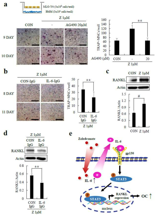 zolendronate에 의해 골세포에서 RANKL 발현이 증가하는 현상은 IL-6 중화항체에 의해 억제됨