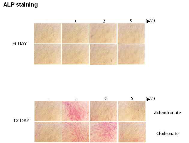zolendronate에 의한 인간 치수줄기세포의 조골세포 분화 억제
