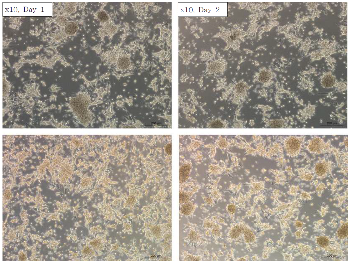 난포액에서 분리한 granulosa cell primary culture한 결과 사진 (x10배)