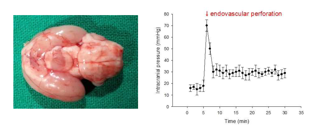 SAH 유도 쥐의 두개내압 변화를 나타낸 그래프 및 적출한 뇌 기저부 사진. 좌) Circle of willis를 따라 출혈 병변이 관찰됨 우) 혈관 천공 후 나타나는 압력의 급격한 증가가 SAH 발생을 반영함