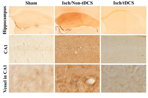 정상군, 뇌허혈 유발군, 뇌허혈 유발 및 tDCS 적용군의 해마, CA1 영역 및 뇌혈관에서 IgG 면역염색