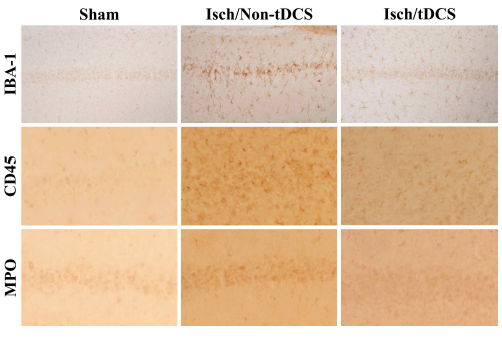 정상군, 뇌허혈 유발군, 뇌허혈 유발 및 tDCS 적용군의 해마 CA1 영역에서 Iba-1 (microglia), CD45 (infilterting mononuclear cell), myeloperoxidase (MPO, neutrophil) 면역염색