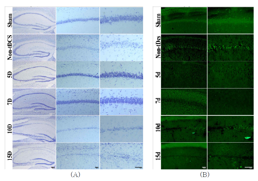 정상군, tDCS미적용군, tDCS적용 뇌허혈 5일, 7일 10일, 15일군 해마 및 CA1 영역 Cresyl violet staining (A) 및 Fluoro-Jade C staining (B)