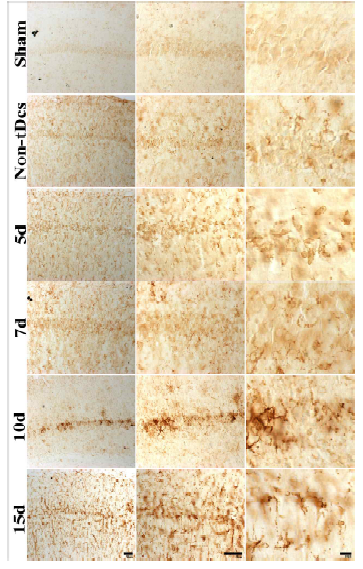 정상군, tDCS미적용군, tDCS적용 뇌허혈 5일, 7일 10일, 15일군 해마 및 CA1 영역 IBA-1 면역염색