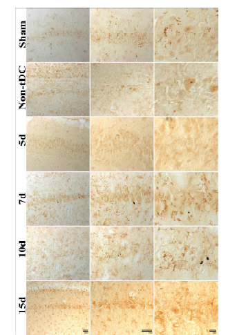 정상군, tDCS미적용군, tDCS적용 뇌허혈 5일, 7일 10일, 15일군 해마 및 CA1 영역 CD45 면역염색