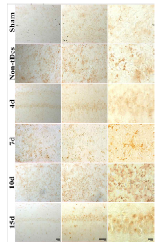 정상군, tDCS미적용군, tDCS적용 뇌허혈 5일, 7일 10일, 15일군 해마 및 CA1 영역 CD45 면역염색