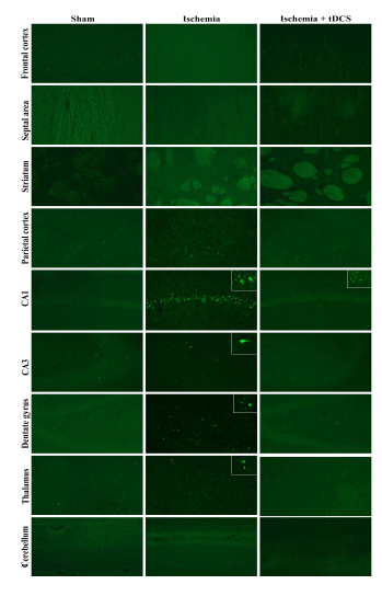 정상군, 뇌허혈 유발군, 뇌허혈유발 및 tDCS 적용군의 뇌영역별 Fluoro-Jade C 염색