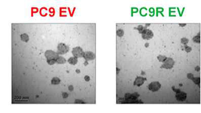 (예시) PC9 폐암세포에서 분리한 엑소좀을 전자현미경을 통해 validation
