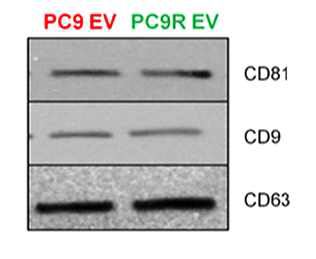 PC9 폐암세포에서 분리한 엑소좀을 특이마커를 통해 validation