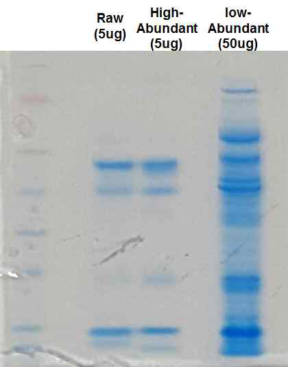 high adundant proteins depletion 진행한 후 SDS-PAGE결과