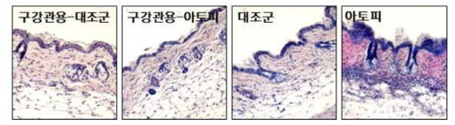 오발부민 구강유도-아토피 피부염 마우스 병변의 염증 완화