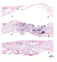 Hematoxylin and eosin stained histological morphology of the entire area of defects at 8 weeks. Black arrow heads indicate the defect margin. Black arrows indicate the mature new bone. (A)Empty;control, (B) HA Hydroxyapatite 60 % Hydroxyapatite 60% & Tri-calcium phosphate 40% + PDRN