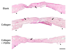 Hematoxylin and eosin-stained histological morphology of the entire area of rabbit calvarial defects after 8 weeks. In Collagen + PDRN groups, more newly formed bone is found in the entire area of defects. Arrow head: marginal defect site. Arrow: new bone. Scale bar = 1mm