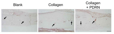 Immunohistochemical localization of platelet endothelial cell adhesion molecule (CD31/PECAM-1) in the center of bone defect after 8 weeks. Immunohistochemistry attempts to evaluate blood vessel using CD31/PECAM antibody (1:25) with DAB. In Collagen + PDRN group, the numbers of blood vessel are found in the center of bone defect. Arrow: blood vessel. Scale bar = 200 μm