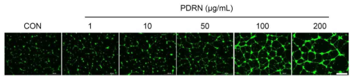 Effect of Polydeoxyribonucleotide (PDRN) on human umbilical vein endothelial cells (HUVECs) tube formation. Angiogenic activity of PDRN was determined by matrigel tube formation. Tube formation photographs showed that vascular tube formation was strongly increased by 100 and 200 μg/mL PDRN treatments. Scale bar = 500 μm