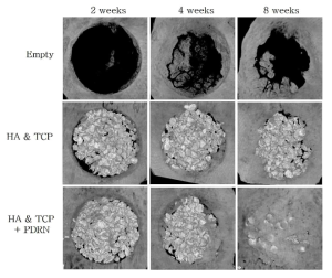 Three-dimensional reconstructed micro-CT images of defects for 2, 4, 8 weeks. The new bone formation shows from margin of defect in the all specimens. At 8 weeks, it was observed that new bone formation in HA control, HA Hydroxyapatite 60 % Hydroxyapatite 60% & Tri-calcium phosphate 40% + PDRN