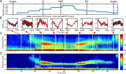 마취의 심도에 따라 변하는 뇌파의 스펙트럼 분석 알고리즘 (Kim et al., 2018)