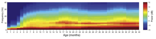 월령에 따른 전두엽 스펙트럼 변화