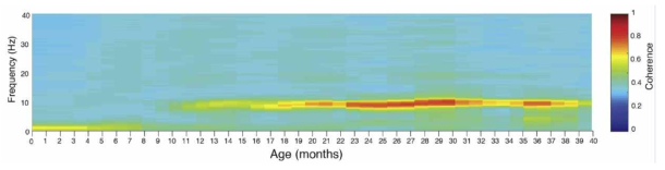 월령에 따른 전두엽 coherence 변화