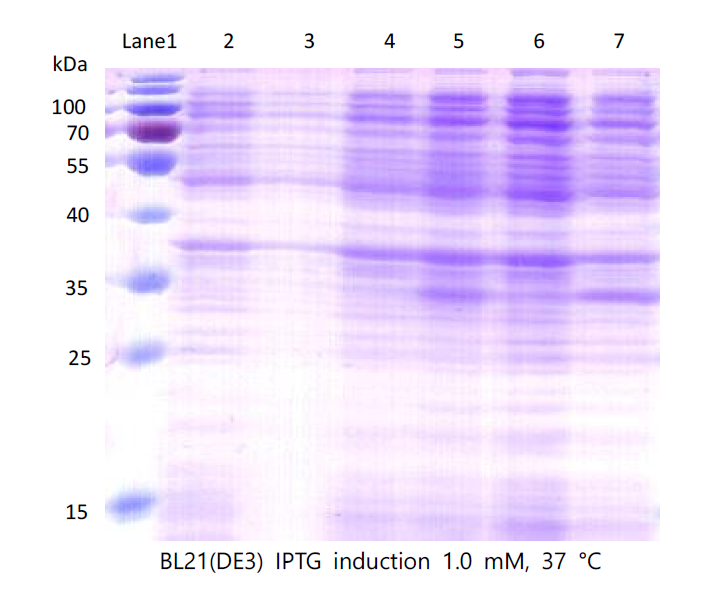 tPA-SPD pET30a(+)를 BL21 (DE3)에 transformation 한 뒤 IPTG로 발현시킨 결과