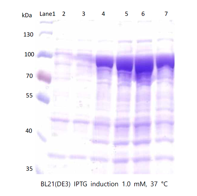 PAI-1 pMAL-c5x을 BL21 (DE3)에 transformation 한 뒤 IPTG로 발현시킨 결과