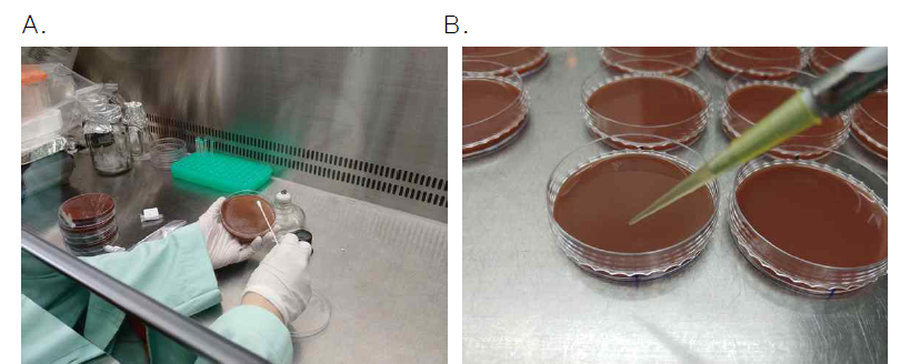 고신대학교에서 시행하고 있는 H. pylori 배양 A. Culture한 plate에서 colony를 채취하는 모습. B. Sample과 표준균주를 접종하는 모습