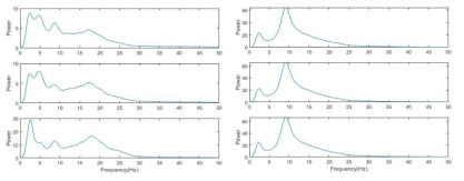 파킨슨병 환자(왼쪽)와 본태성 진전 환자(오른쪽)의 파워스펙트럼 분석