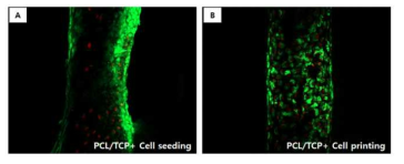 cell을 dipping한 scaffold와 printing한 scaffold의 live/dead 염색을 실시한 결과. Printing한 scaffold에서 좀 더 균일한 간격으로 세포들이 증식하고 있음을 확인할 수 있었음