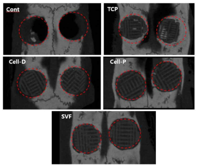 스캐폴드 삽입 12주에 채취한 조직의 micro-CT 영상