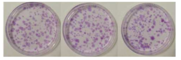 지방줄기세포를 이용하여 콜로니 형성능을 확인한 결과