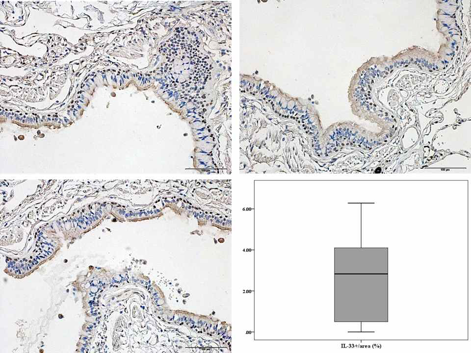 폐 조직에서 IL-33 expression